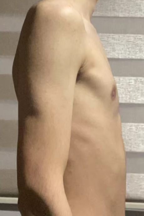 Ben after posture coaching — improved alignment