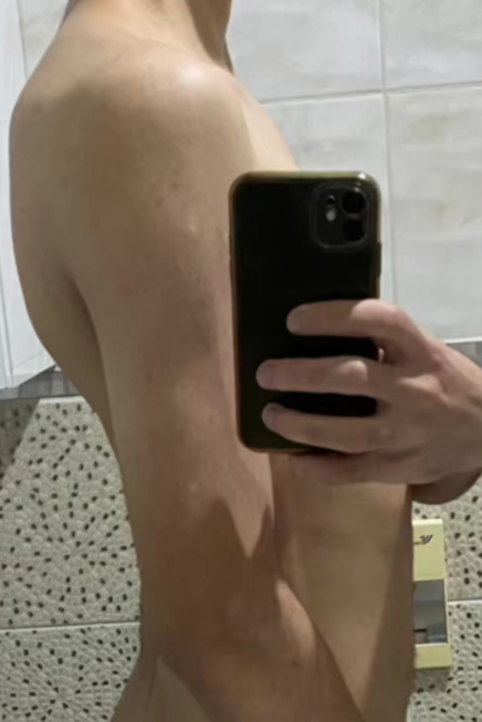 Ben before posture coaching — extreme lower back arch